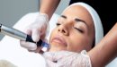 جهاز ديرما بن (Dermapen): الفوائد والأضرار الجانبية