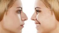 آثار عملية تجميل الأنف