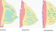التهاب غدد الحليب التهاب غدد الحليب