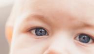 التهاب عين الطفل