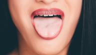 أفضل علاج لتقرحات الفم واللسان