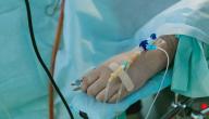 ما هو مرض الجامود؟ ما هو مرض الجامود؟