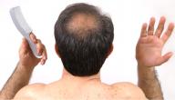 علاج تساقط الشعر الوراثي عند الرجال