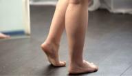 اعراض دوالي الساقين اعراض دوالي الساقين