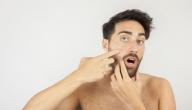 علاج مرض داء اللؤلؤ علاج مرض داء اللؤلؤ