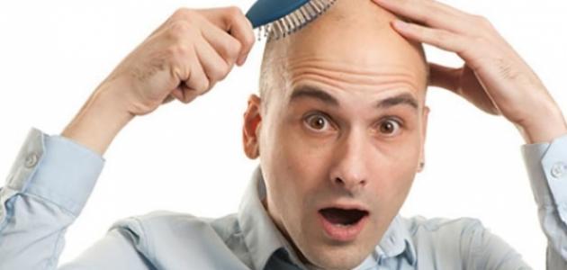 ما هو علاج الصلع المبكر