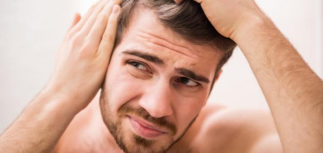 أسباب قشرة الشعر وعلاجها