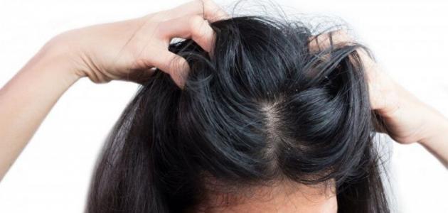طرق الوقاية من قمل الرأس