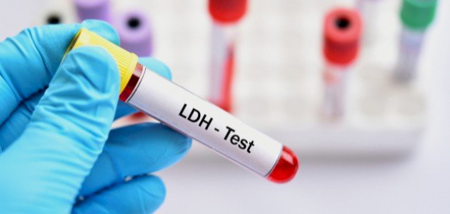 تحليل LDH: هل تختلف النسبة الطبيعية باختلاف الجنس؟
