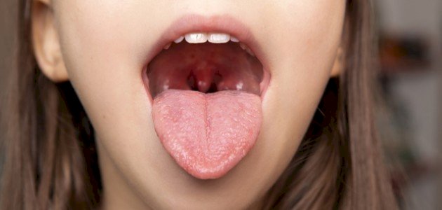 فوائد اللوزتين: خط دفاع في جهازك المناعي!