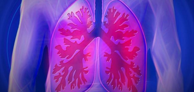 علاج مرض السل