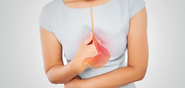 علاج حموضة المعدة