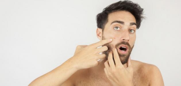 علاج مرض داء اللؤلؤ